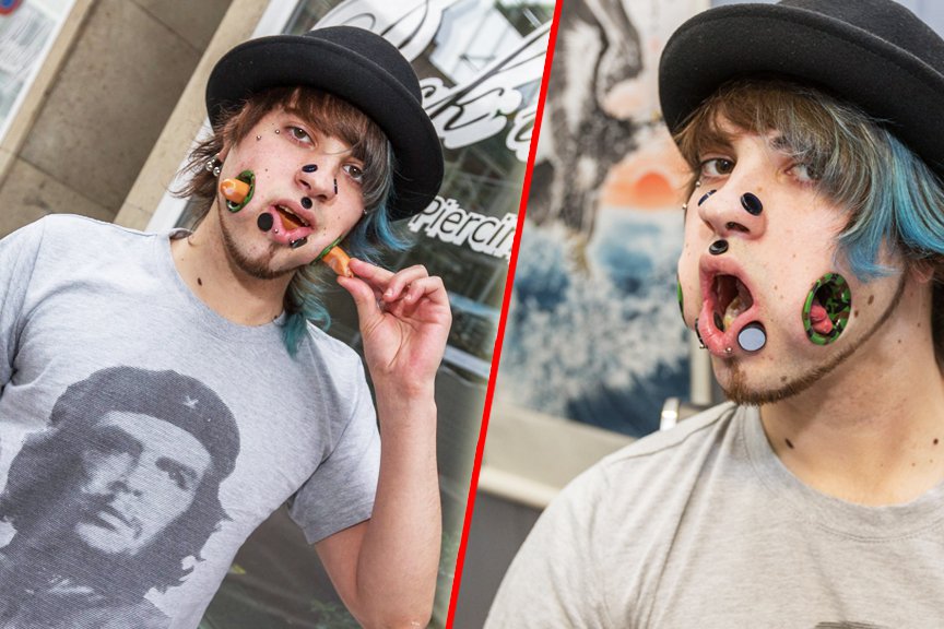 Тунелі в щоках