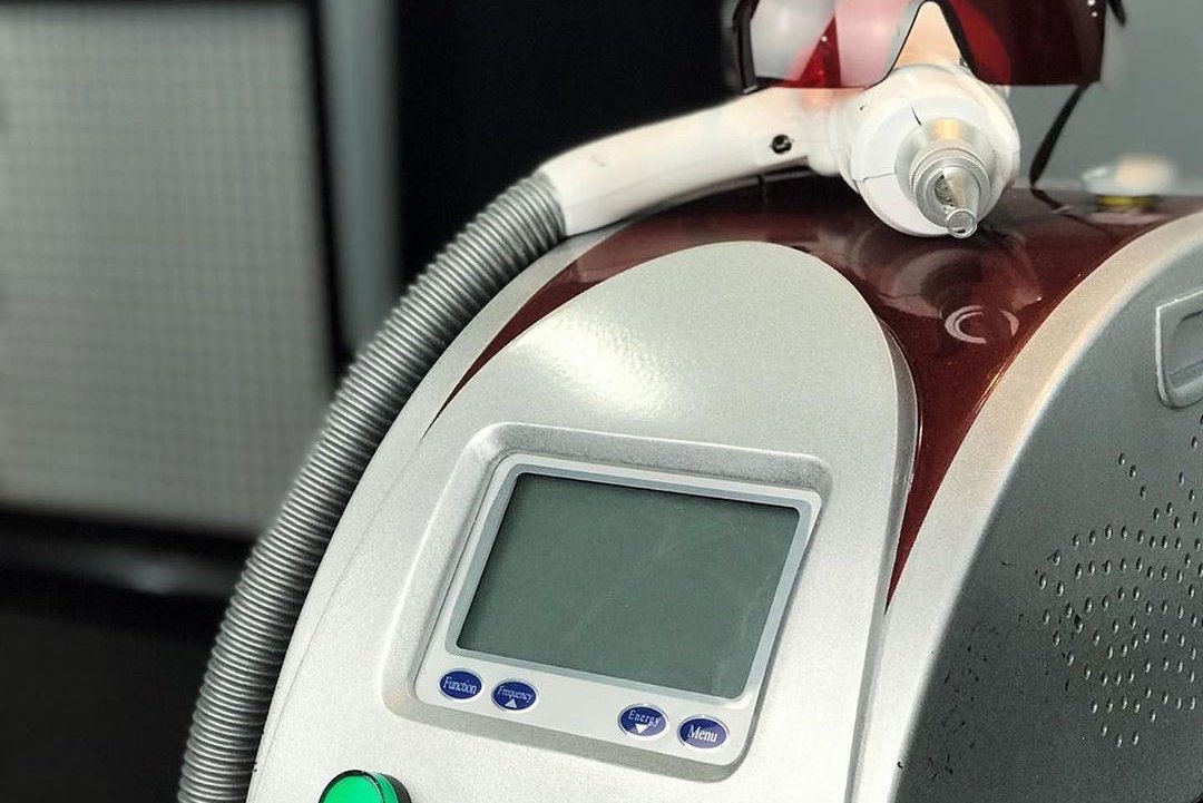 Видалення тату в Івано-Франківську