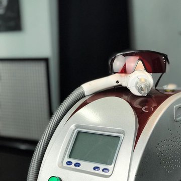 лазерное удаление тату