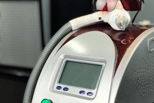 Удаление татуажа в Запорожье