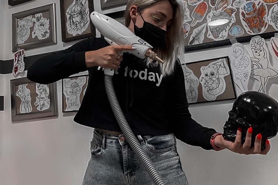 Удаления тату в Каменском