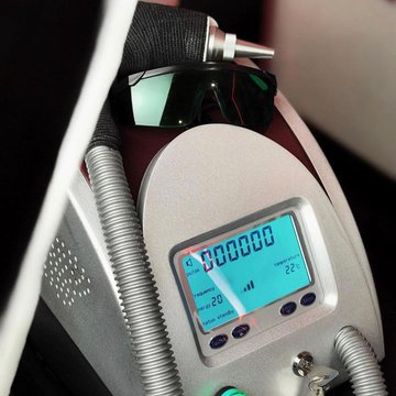 Видалення тату в Рівному