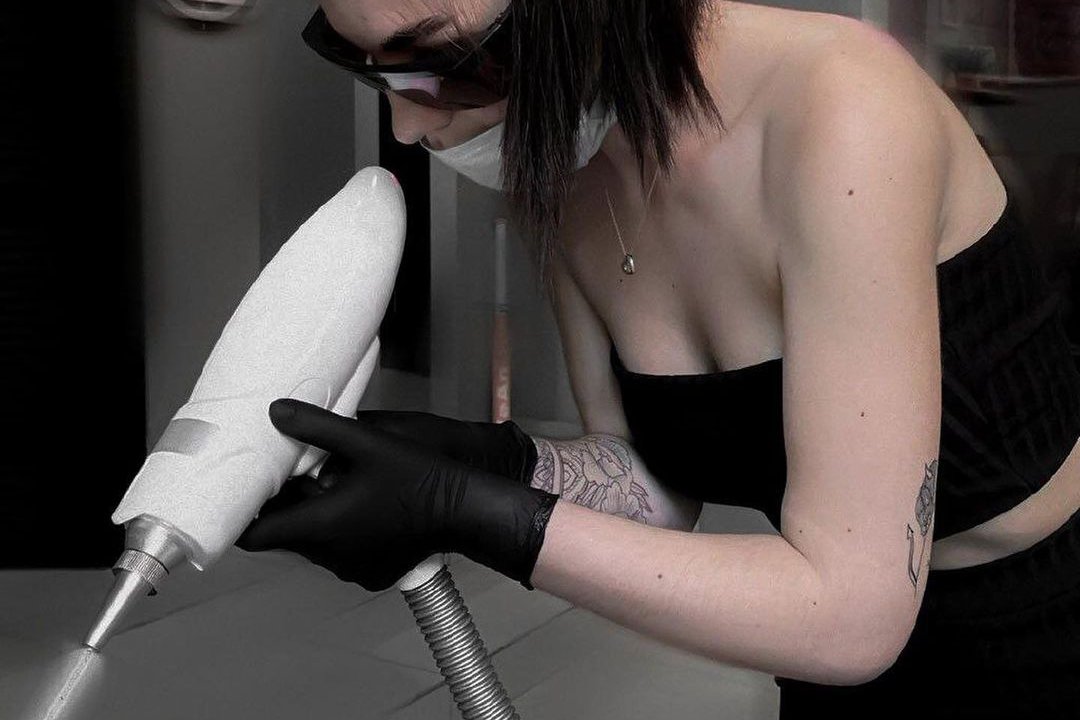 удаление татуажа в Бахмуте