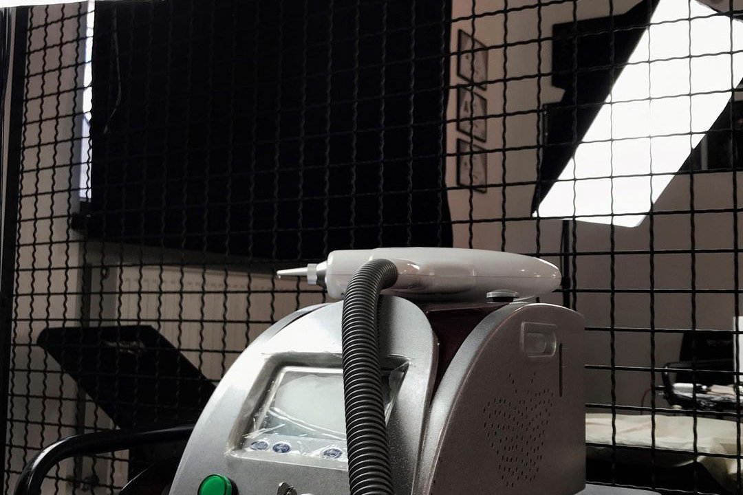 Удаление тату в Херсоне