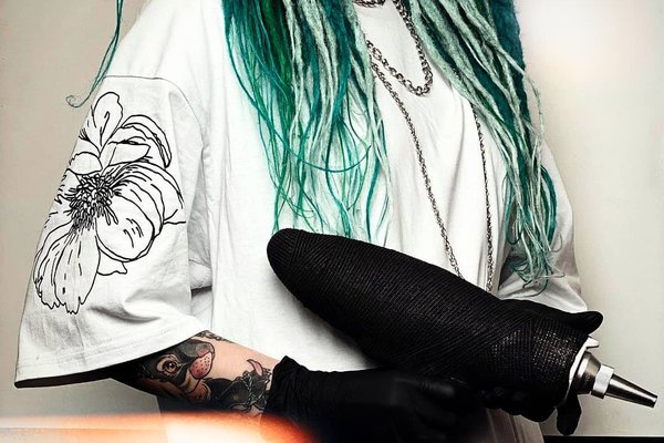 удаление татуажа в Никополе