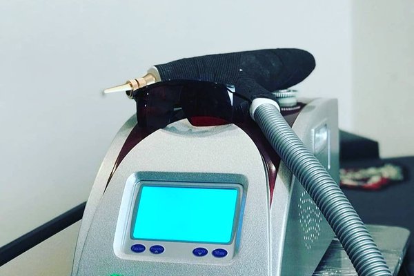 Видалення татуажу лазером