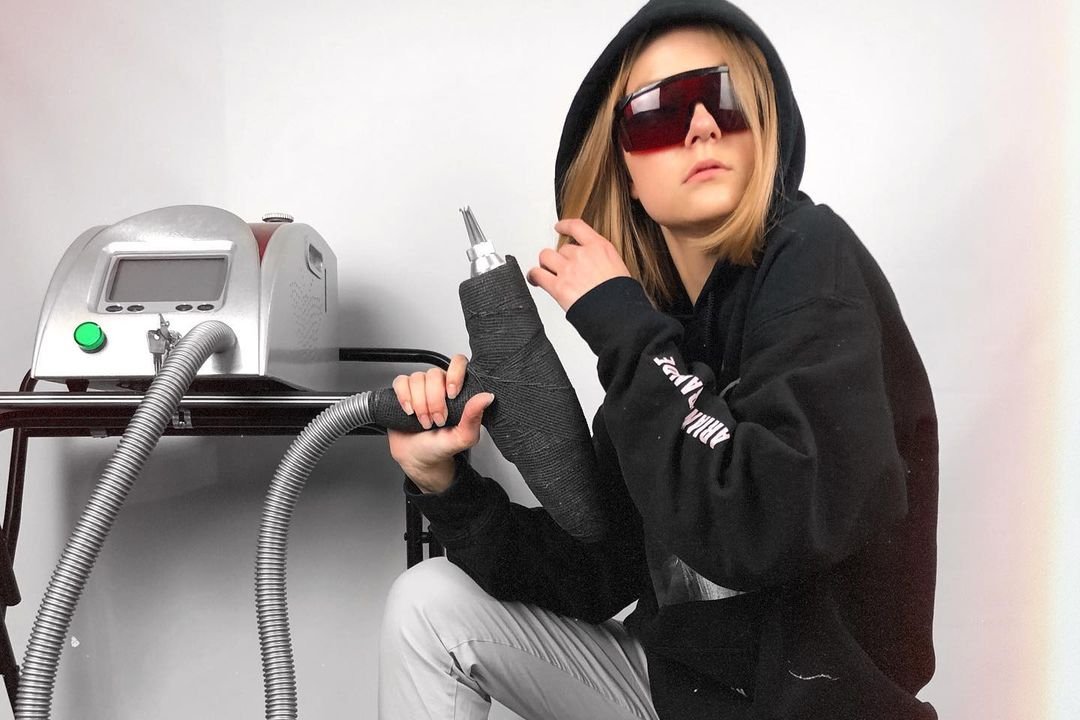 Видалення татуажу у Павлограді