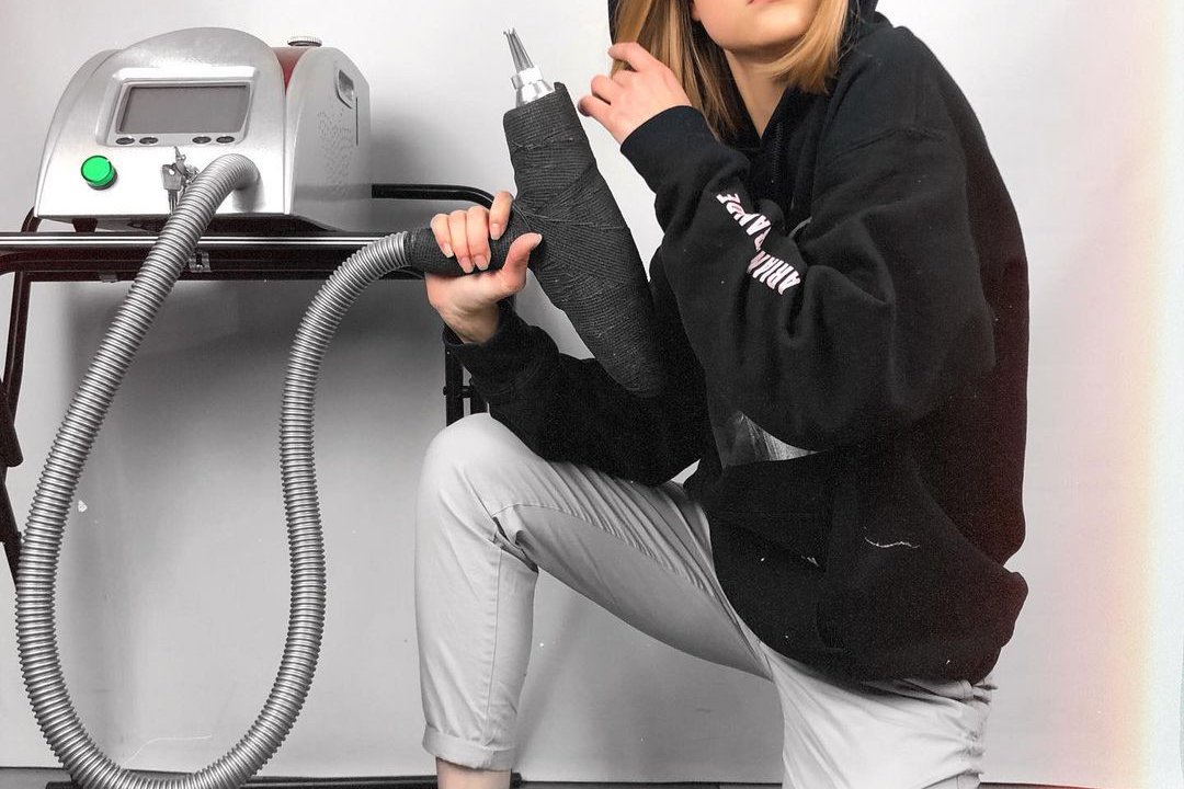 Удаление тату в Броварах