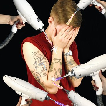 Удаление татуажа в Киеве