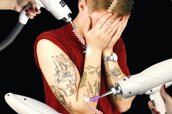 Видалення тату в Краматорську