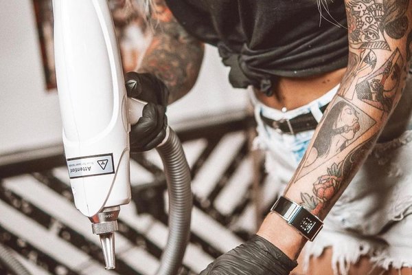 Удаление татуажа в Черкассах