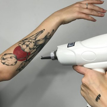 Удаление тату в Херсоне