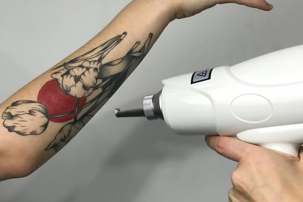 Особенности лазерного оборудования