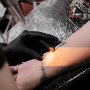 Видалення тату в Кам'янець-Подільському