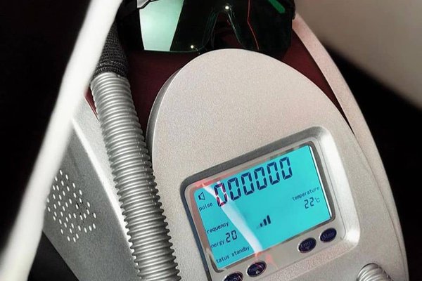 Видалення татуажу у Бахмуті