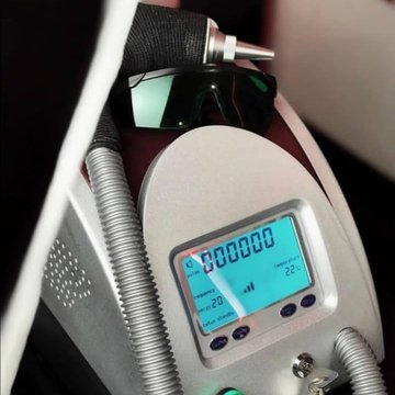 лазерный аппарат