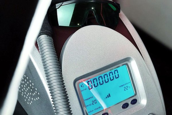 Удаление тату в Запорожье