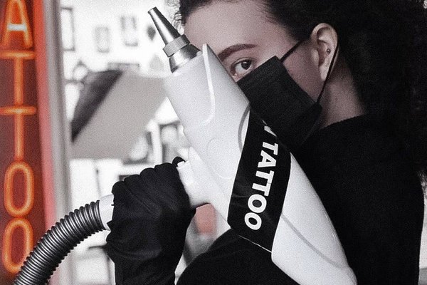 Удаление тату в Ужгороде