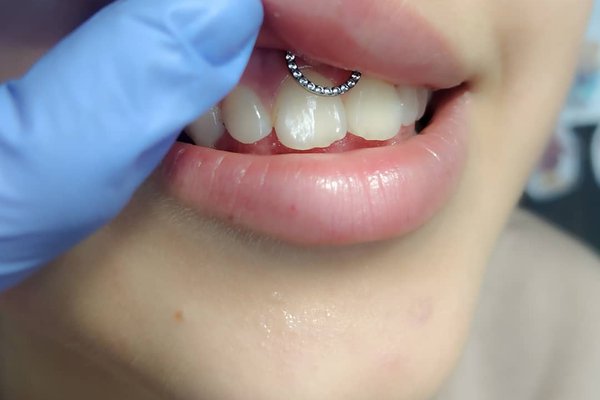 Все учителя и консультанты, которые с нами сотрудничают, являются опытными профессионалами и имеют практику работы за рубежом. Согласно составленному плану, по которому проводится программа обучения пирсинга, вы обретете знания и навыки, в кратчайшие сроки. Тот багаж знаний, который вы получите, останется с вами навсегда.  Это выгодная инвестиция, которую вы в силах сделать. Заплатив за обучение всего лишь раз, вы получаете постоянную профессию, которая будет кормить вас всю жизнь. Нужно акцентировать внимание на том, что все теоретические знания, закрепляются практическими тренировками, которые проходят под руководством опытных инструкторов.  Многолетний опыт наших учителей, предастся вам, вместе с базовыми знаниями. Все тесты и практические отработки, производятся на манекенах. Наши опытные сотрудники, укажут на существующие недоработки и проблемы, которые по началу будут присутствовать в вашей технике. Коррекция и оттачивание ваших навыков, главная задача инструкторов.