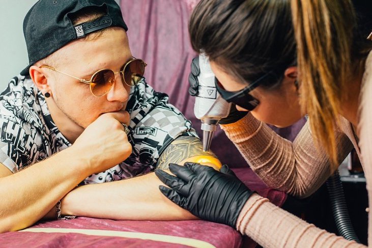 Удаление тату в Белой Церкви