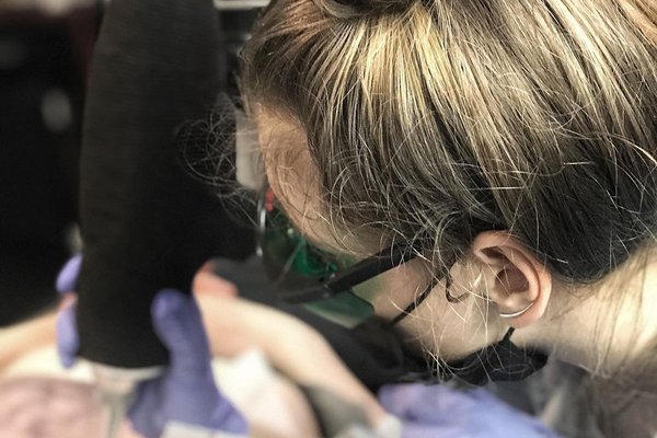 Переваги лазера