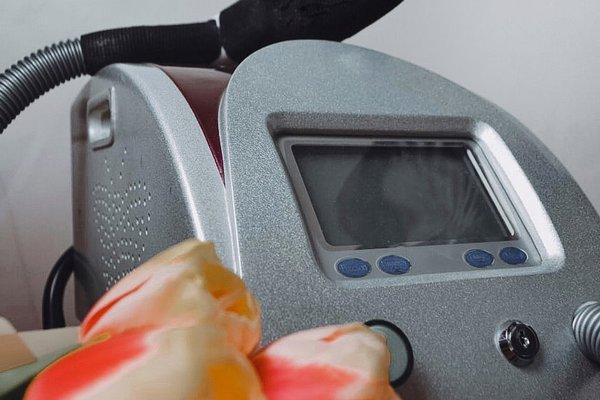 Удаление тату в Ужгороде