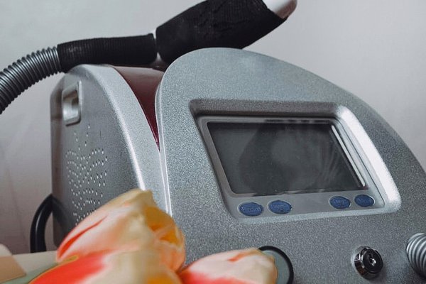 Удаление тату в Кременчуге