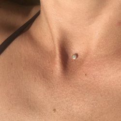 Мікродермал