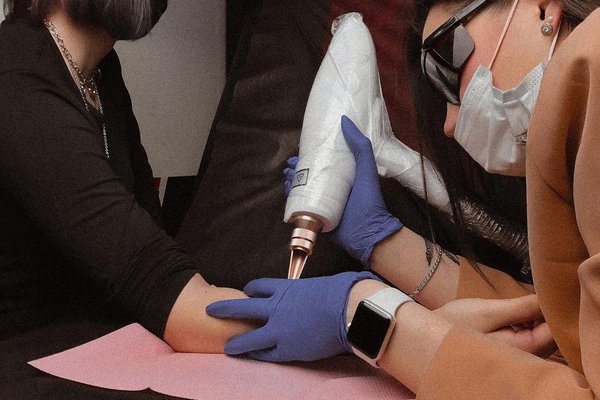 Преимущества удаления тату в "VeAn"