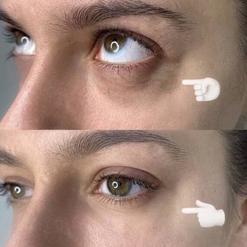 Татуаж кіл під очима