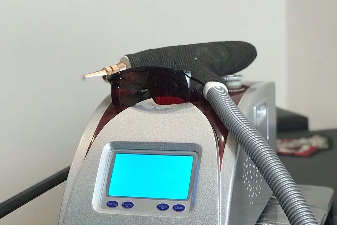 Удаление тату в Павлограде