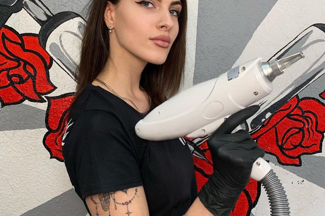 Удаление тату в Виннице