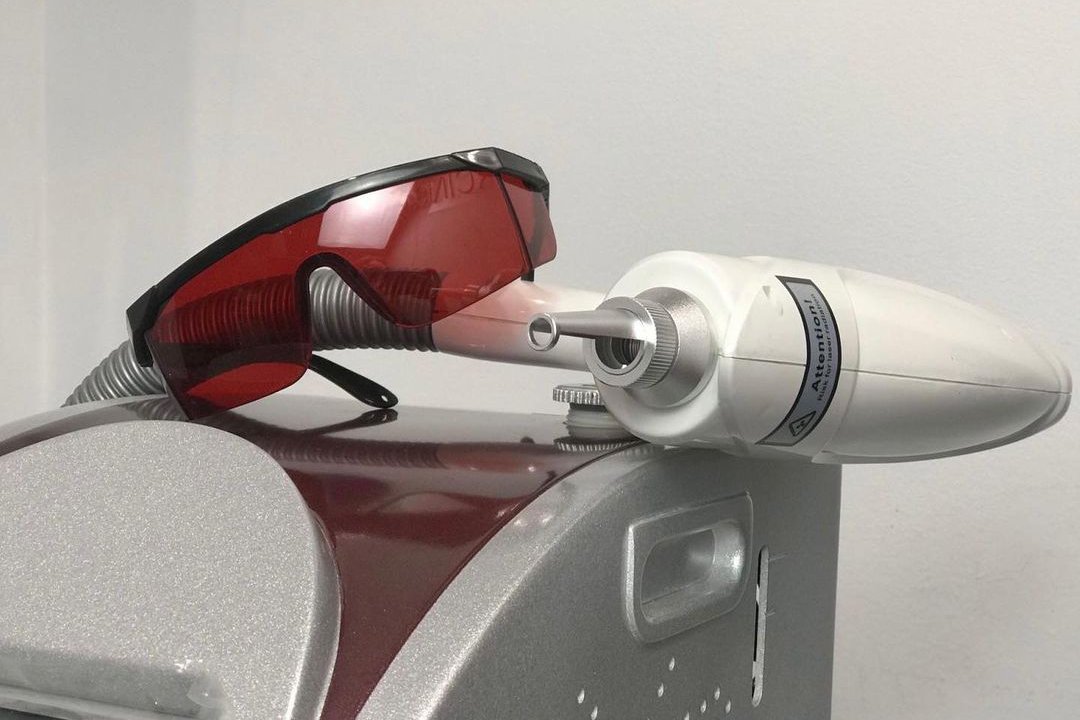 Удаление татуировки в Одессе