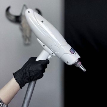 Видалення тату в Борисполі