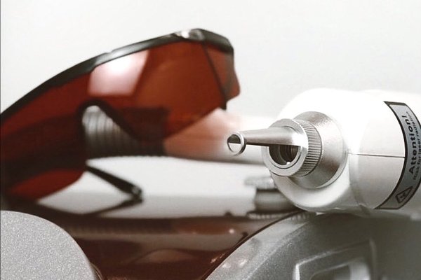 Видалення татуажу в Києві