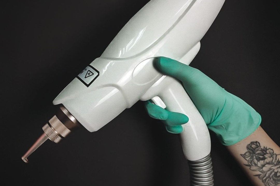 Видалення татуажу у Хмельницькому