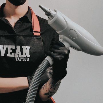 Видалення татуажу в Києві