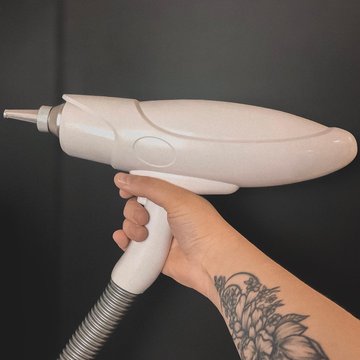 Видалення тату в Калуші