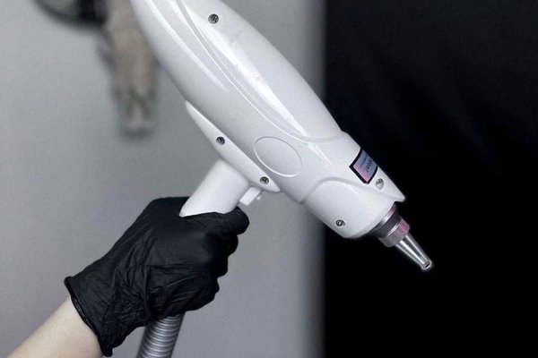 Лазерне видалення тату: ефективність, ризики