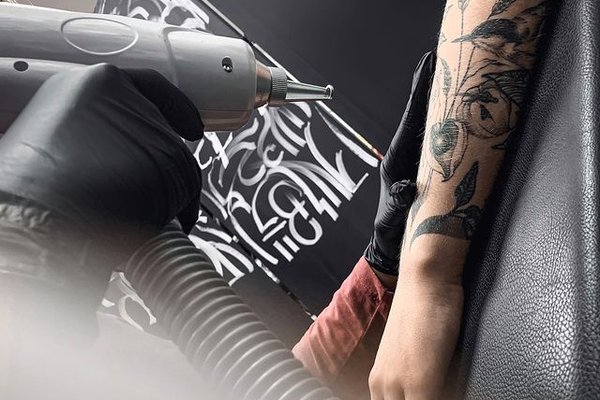 Удаление тату в Умани