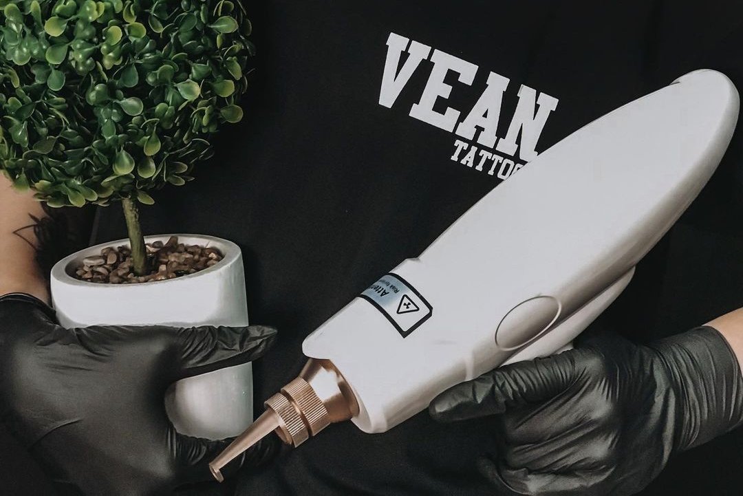 Видалення татуажу в Умані