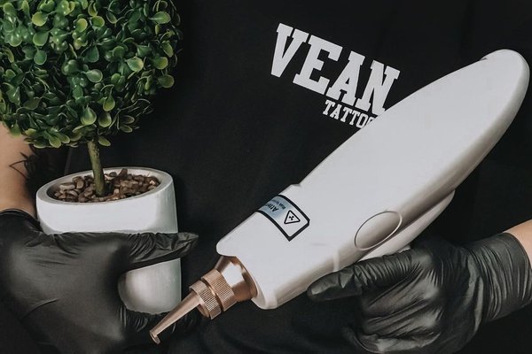 Видалення тату в Умані