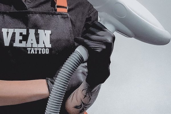 Видалення тату у Хмельницькому