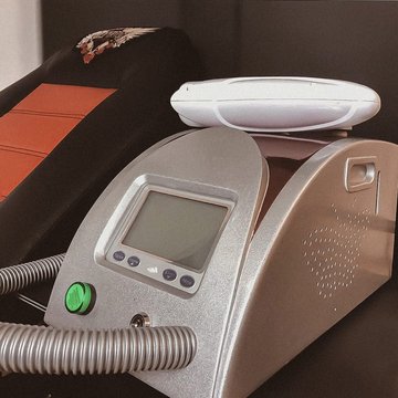 Видалення тату в Калуші