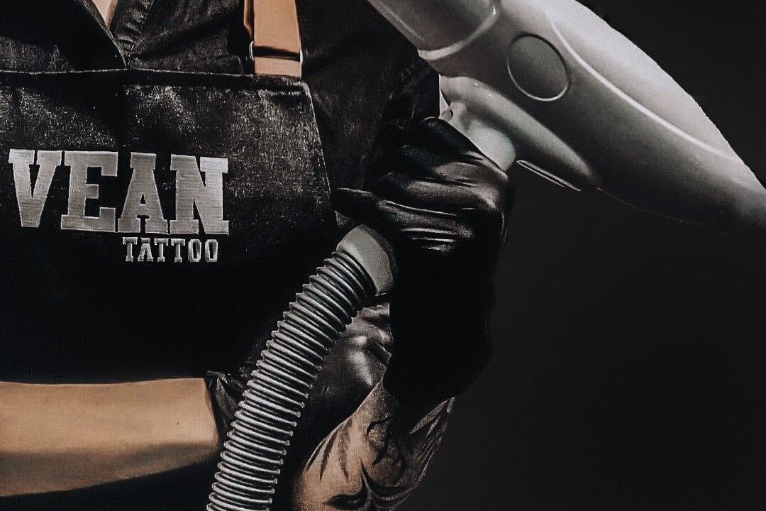 Видалення татуажу в Кременчуці