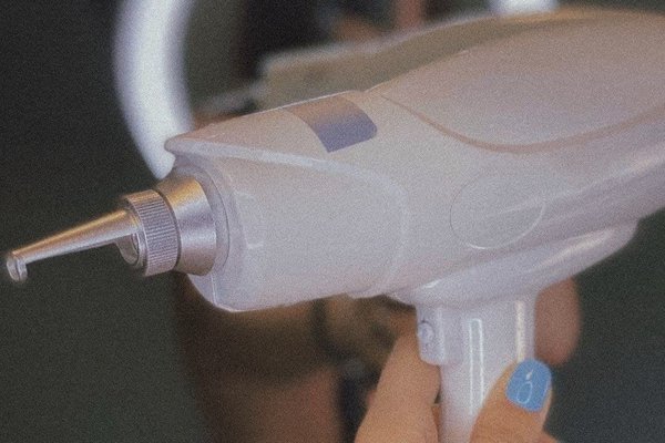 Видалення татуажу у Бахмуті