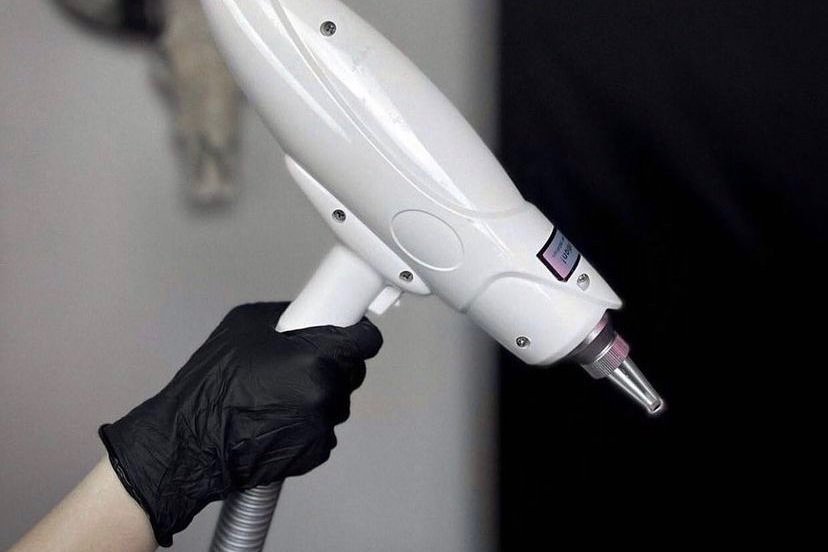 Удаление тату в Умани