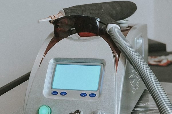 Видалення татуажу в Білій Церкві