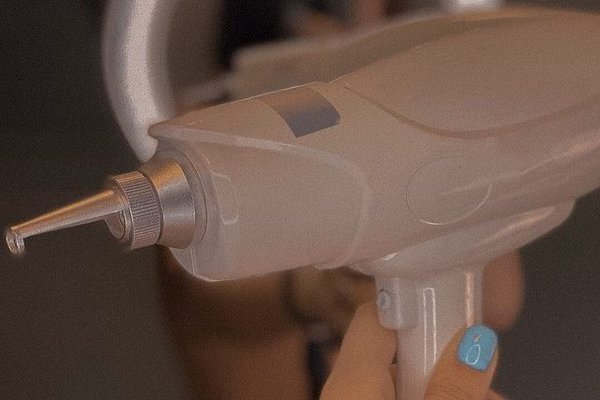 Лазерне видалення тату у Бердянську