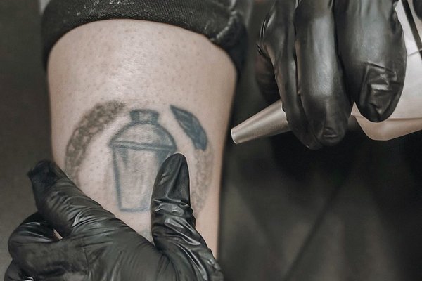 Видалення тату в Умані